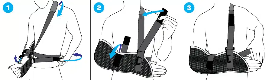 Sports Arm Sling How to Apply