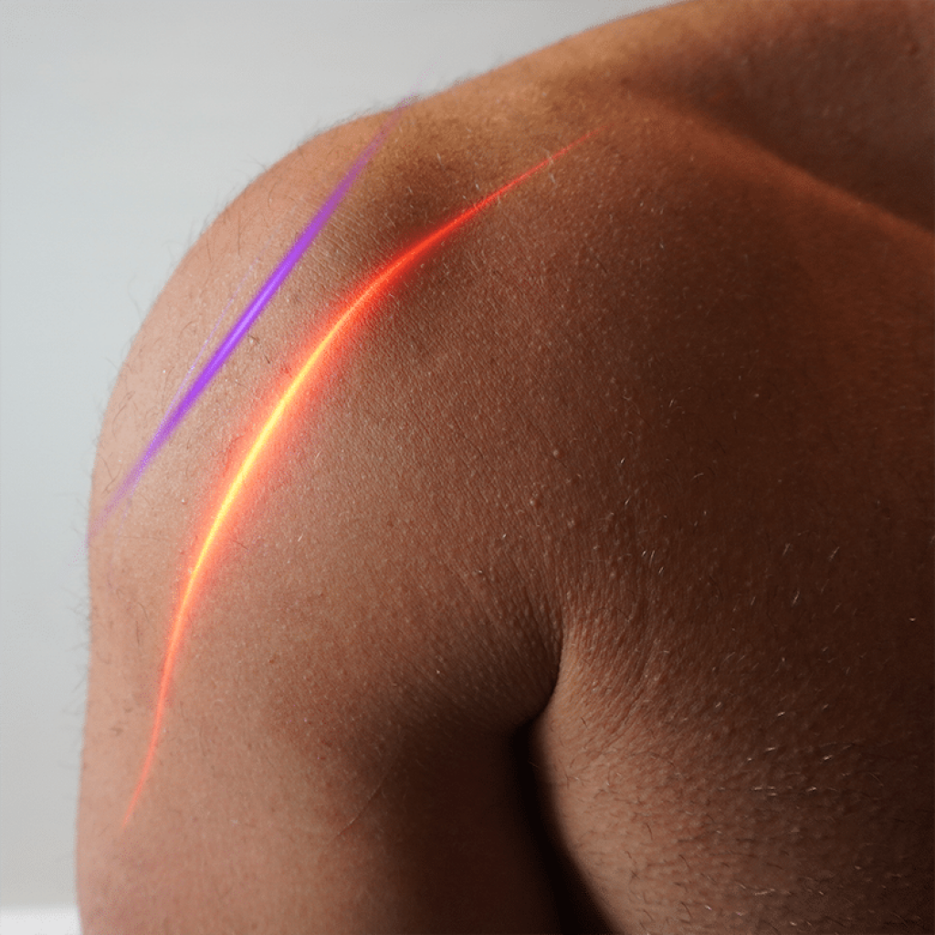 lower level laser therapy treatment